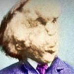 Top 10 Interesting Facts About The Elephant Man