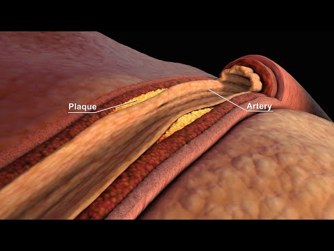 LDL and HDL Cholesterol | Good and Bad Cholesterol | Nucleus Health