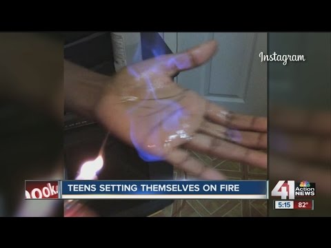 Fire challenge has kids setting themselves on fire