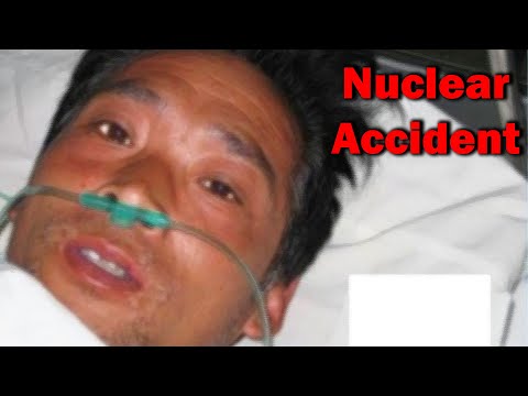 The Most Radioactive Man in History - Hisashi Ouchi