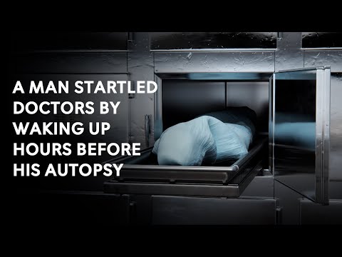 A man startled doctors by waking up hours before his autopsy