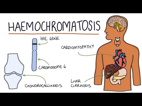 Understanding Haemochromatosis