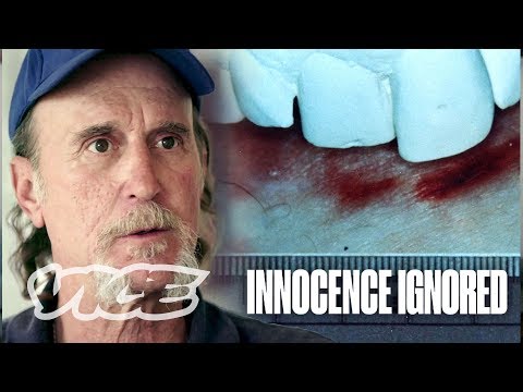 Top 10 Criminal Cases Involving Human Teeth - 48