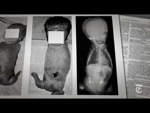 The Shadow of the Thalidomide Tragedy | Retro Report | The New York Times