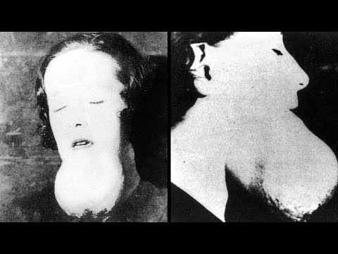 The Terrifying Story Of The Radium Girls