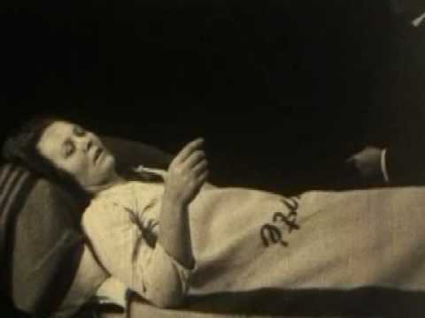 Acute Encephalitis Lethargica (1925)