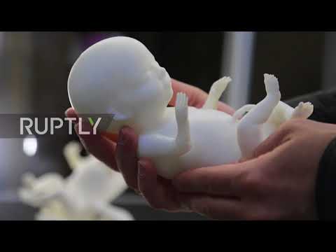 Russia: Expectant mothers can now print 3D models of their unborn