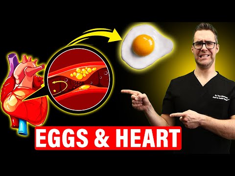 The SHOCKING Truth About Eating Eggs Daily [Heart &amp; Artery Disease]