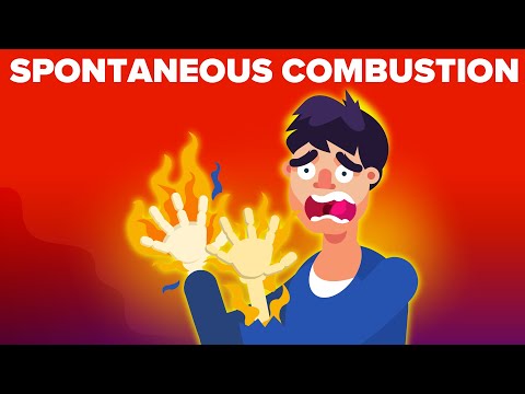 A Real Case Of Spontaneous Human Combustion