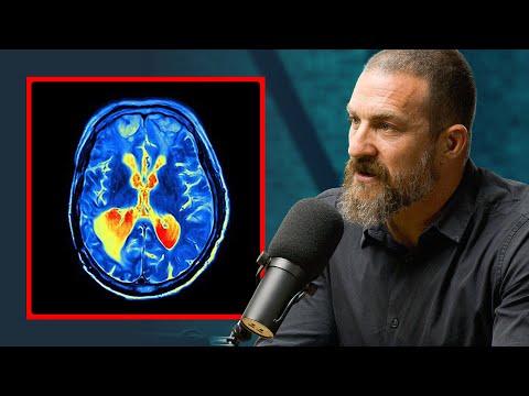 How Dopamine Dominates Our Anticipation - Explained by Andrew Huberman