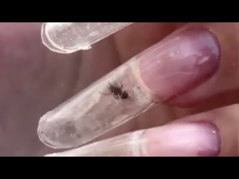 Nail salon puts live ants in fingernails