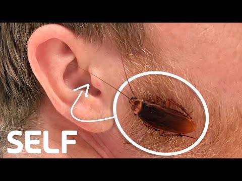 Can a Cockroach Get Stuck in Your Ear? | How Common Is It? | SELF