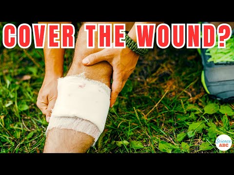 Do Wounds Heal Faster Covered Or Uncovered?