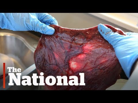 Don&#039;t eat placenta, medical experts say