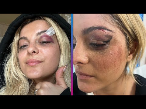 Bebe Rexha Struck in Face With Cellphone During NYC Show