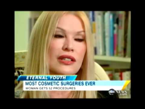 Most Plastic Surgeries Ever - Cindy Jackson World Record