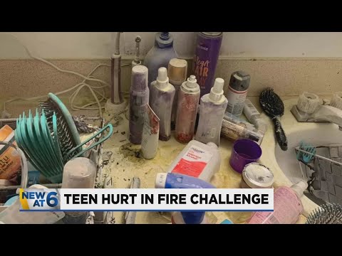 Portland Teen in ICU after attempting fire TikTok challenge