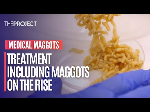 Medical Maggots: Treatment Including Maggots On The Rise Across The World