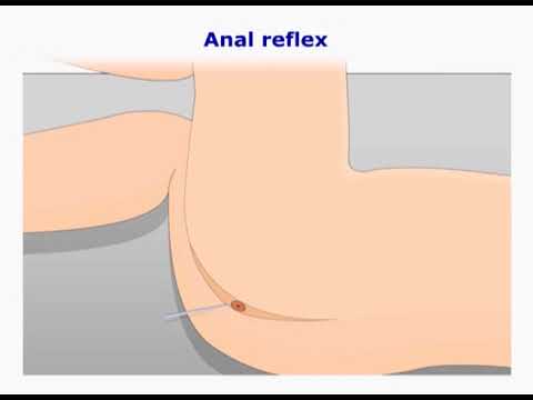 Anal reflex - Anal wink - perineal reflex