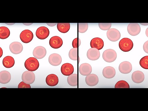 Sickle Cell: Natural Selection in Humans | HHMI BioInteractive Video
