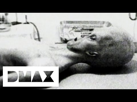 Video Footage Of An Alien Autopsy Sheds Light Over UFO Mystery | World&#039;s Strangest UFO Stories