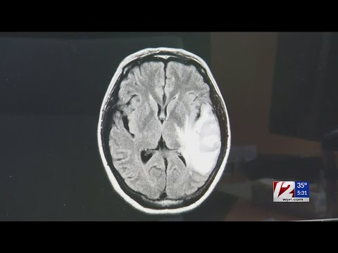 Researchers announce breakthrough in brain cancer vaccine trial