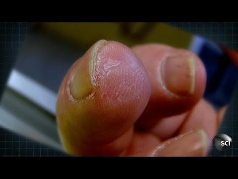 How to Grow a New Fingertip | World&#039;s Strangest