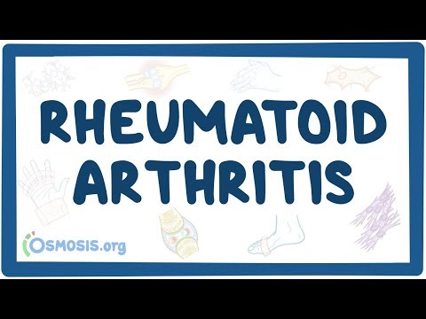 Rheumatoid arthritis - causes, symptoms, diagnosis, treatment, pathology