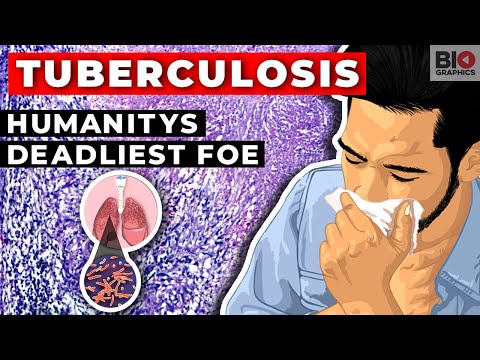 Tuberculosis: Humanity&#039;s Deadliest Foe