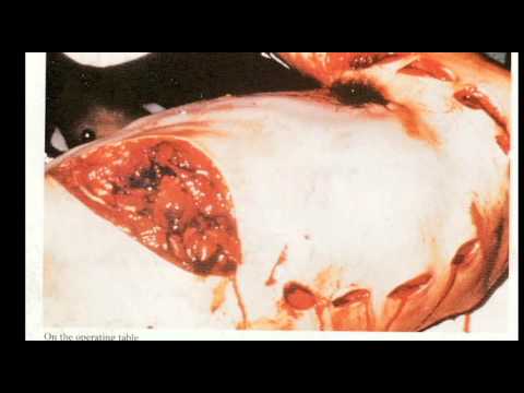 Rodney Fox: Shark Attack