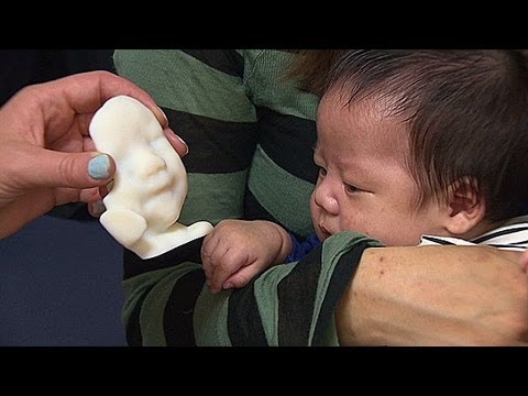 Get a 3D print of your unborn baby