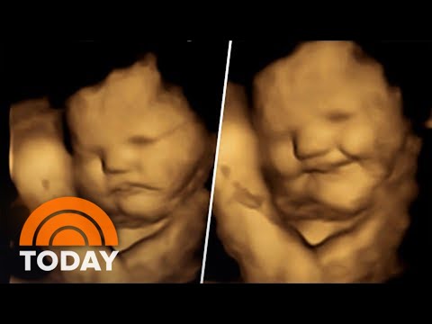 4D Ultrasound Images Show Babies Possible Reaction To Flavors