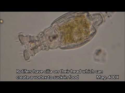 Rotifers under the microscope