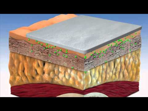 Nanobandage for Wound Healing