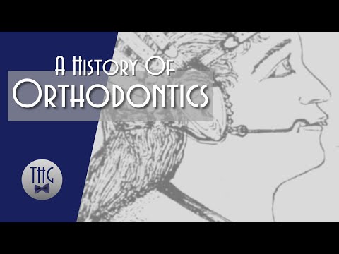 Straightening Marie Antoinette&#039;s Smile: The History of Orthodontics
