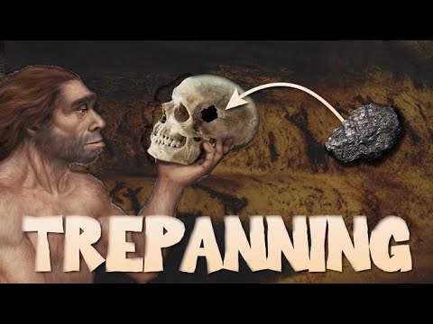 The History of Trepanning