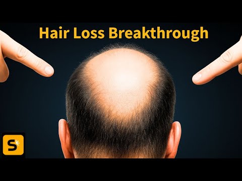 DNA sugar BREAKTHROUGH could treat hair loss