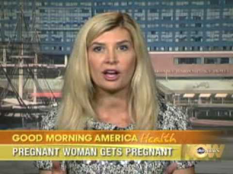 Top 10 Bizarre Pregnancies - 84