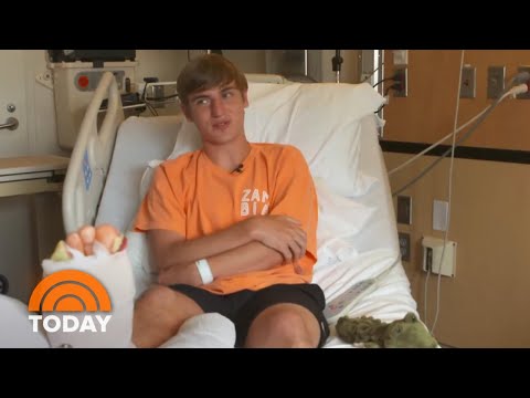 Shark Attack Victim In North Carolina Speaks Out About Terrifying Encounter | TODAY