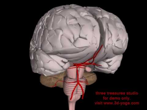 intracranial aneurysm and the 3D brain