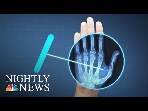 ID, Wallet, Keys All In Your Hand: Sweden Moves Into The Future With Microchipping | Nightly News