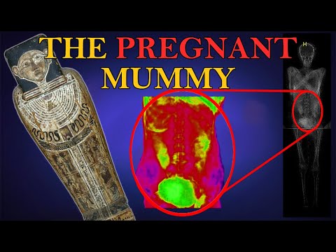 Pregnant mummy! The unknown Lady of Warsaw