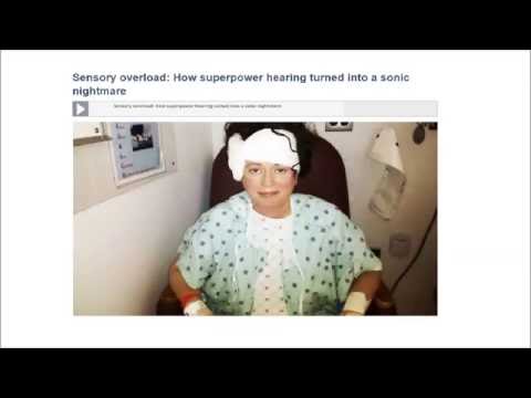 Superior Canal Dehiscence - Pam Gilbert&#039;s Story - 2016