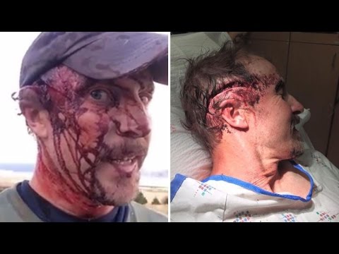 Hiker Details How He Survived Being Horrifically Attacked By Grizzly Bear Twice