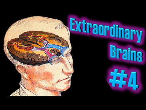 Anton&#039;s Syndrome: The Brain That Is Blind But Thinks It Can See | Extraordinary Brains #4