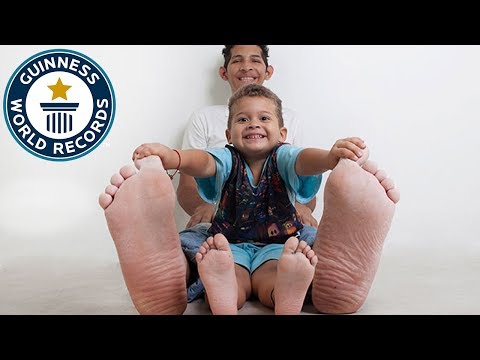 Jeison Rodriguez Hernandez: Largest feet in the world! - Guinness World Records