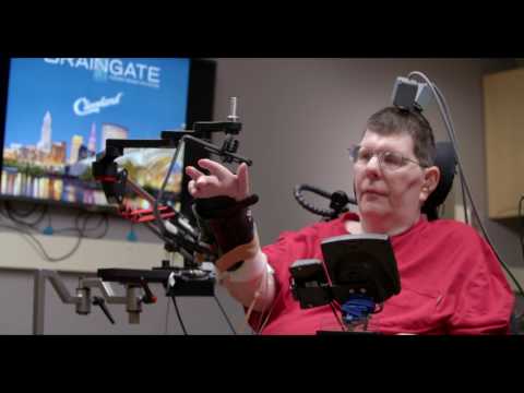 Man with quadriplegia employs injury bridging technologies to move again - just by thinking​