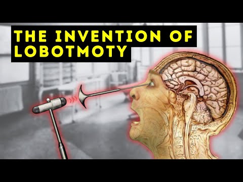 The Man Who Invented the Lobotomy - António Egas Moniz - Documentary