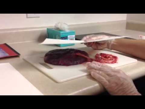 How to make a placenta print