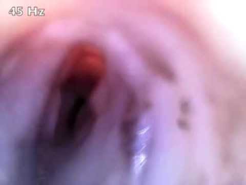 A koala&#039;s vocal cords